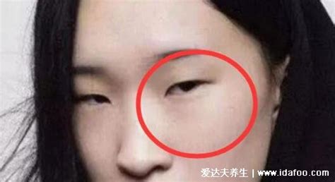 死鱼眼面相|死鱼眼的女人面相